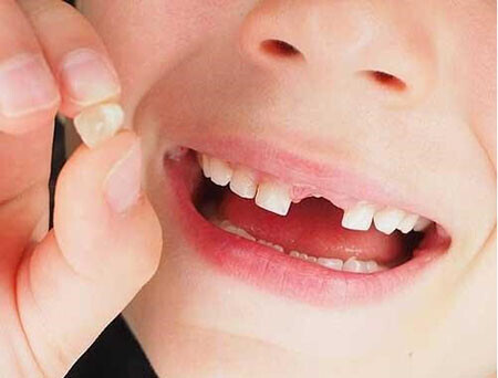 tooth-loss-different-countries-04e5a6af40418b7caf.jpg